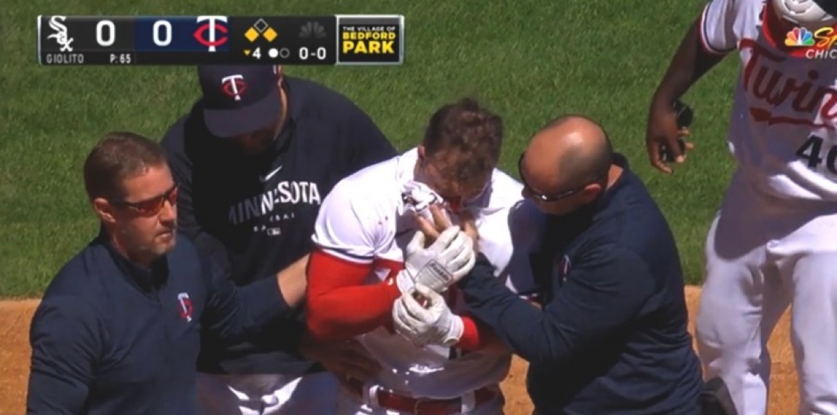 WATCH: Minnesota Twins Infielder Kyle Farmer Hit by Pitch in the Face -  Fastball